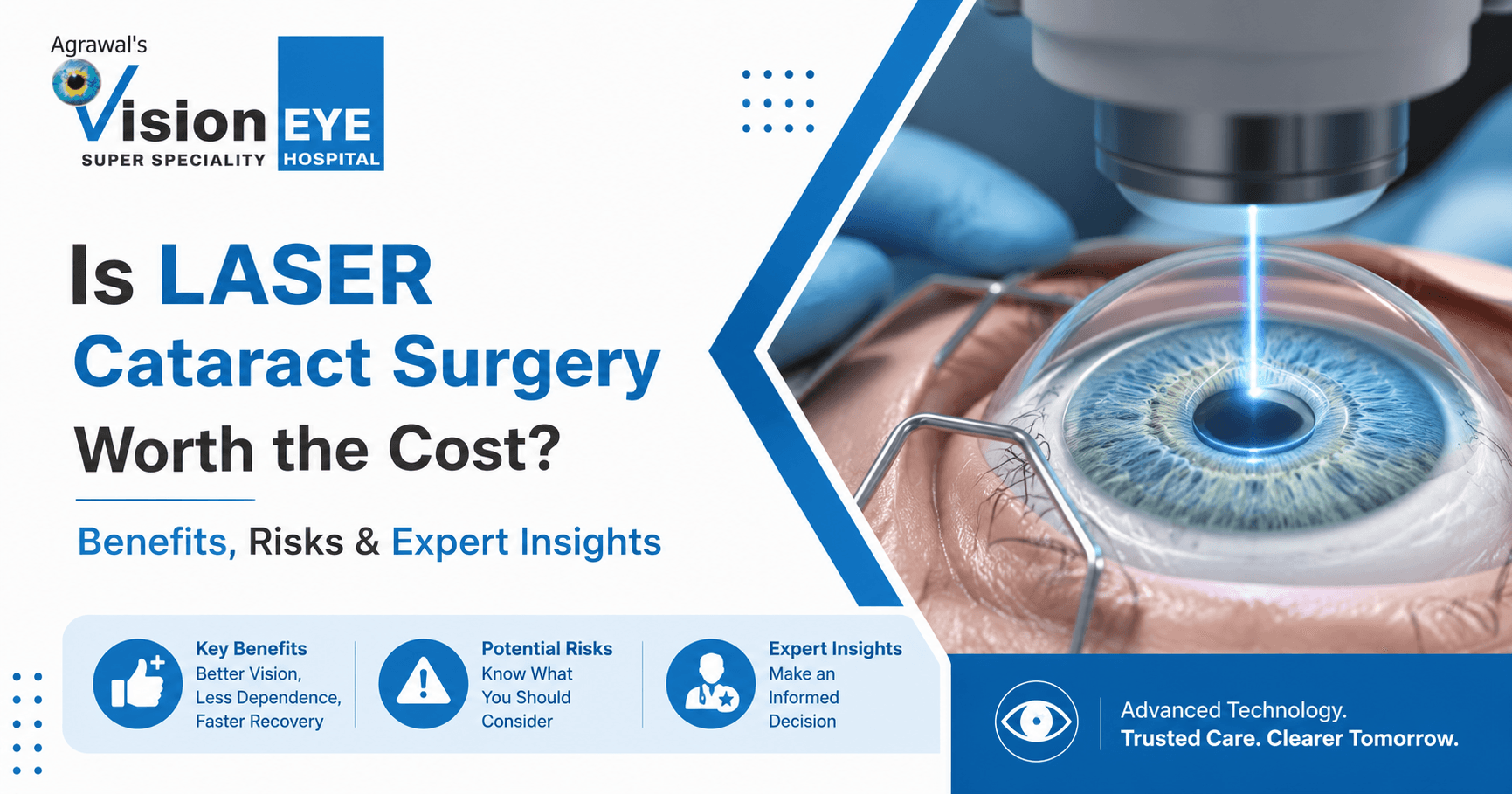 Laser Cataract Surgery Procedure