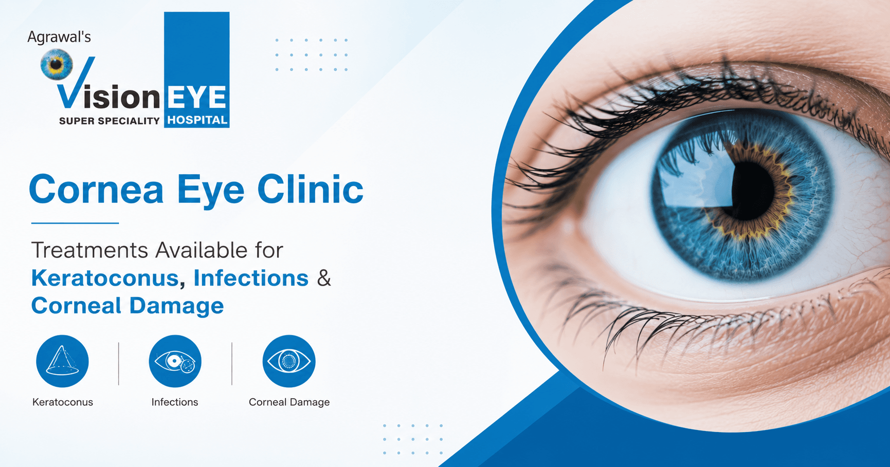 cornea specialist hospital