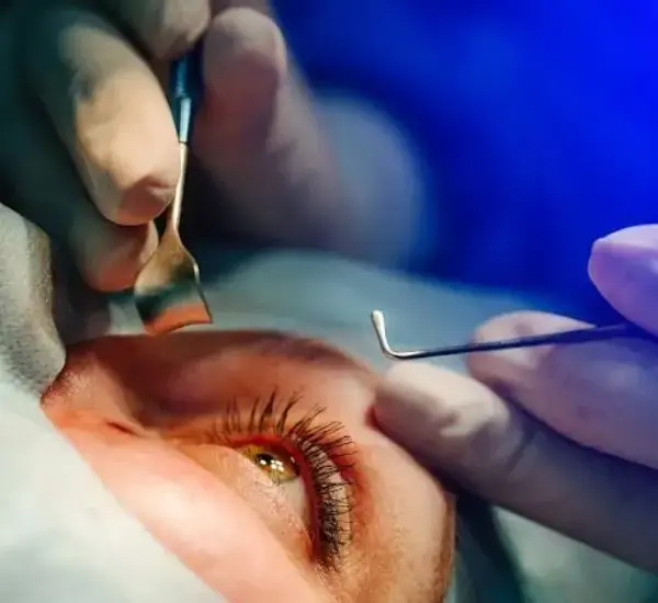 Cataract Symptoms And Treatment 2 Cataract Symptoms 2