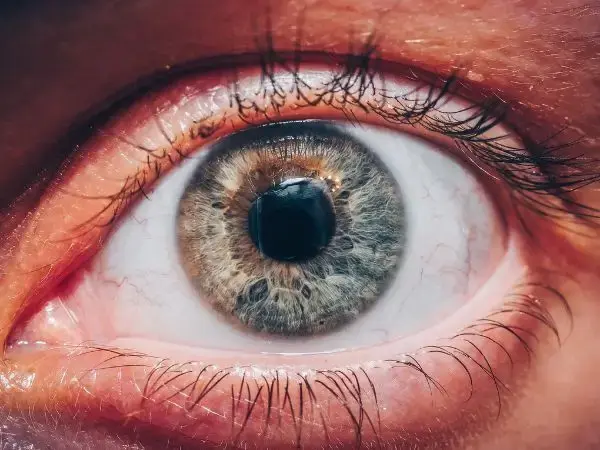 Glaucoma Symptoms and Treatment