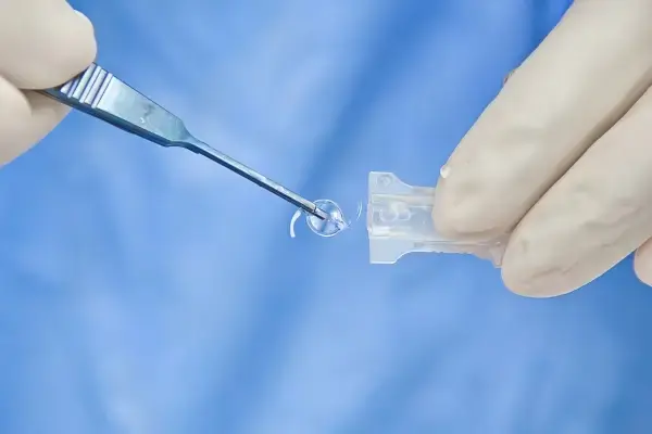Premium Lens Implant Surgery In Surat 2 Premium Lens Implant Surgery