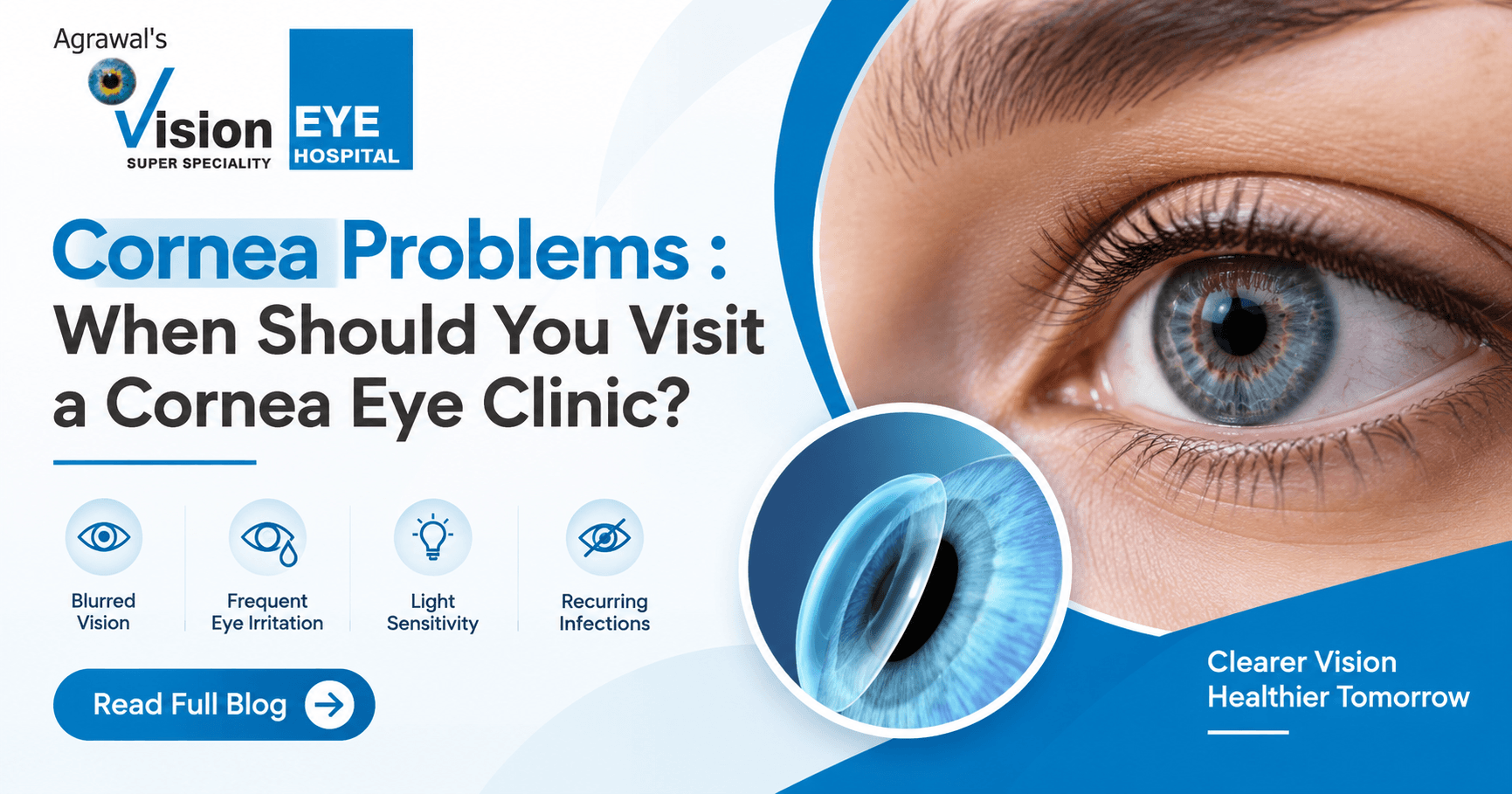 Cornea eye clinic in Surat for diagnosing corneal problems and vision issues