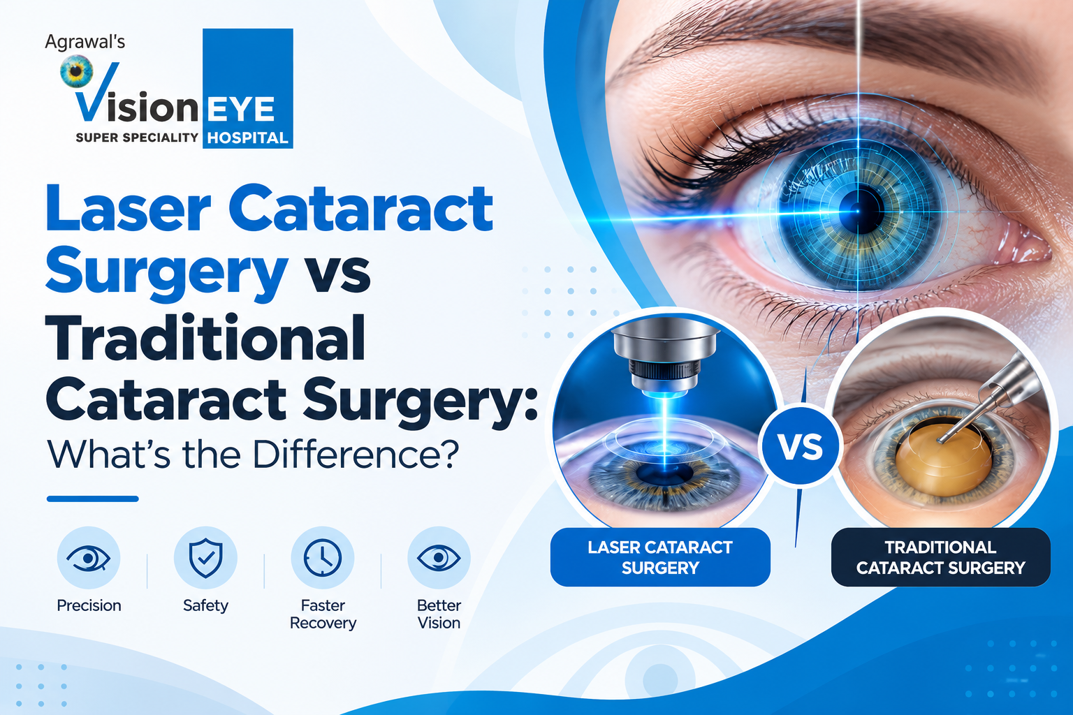 Laser Cataract Surgery vs Traditional Cataract Surgery 1